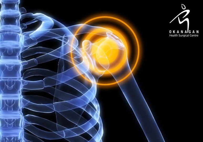 Orthopedic Shoulder Surgery: The Benefits Of Shoulder Arthroscopy